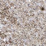 Kir3.4 (KCNJ5) Polyclonal Antibody