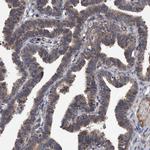 ITIH3 Antibody in Immunohistochemistry (Paraffin) (IHC (P))