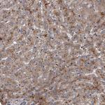 ITIH3 Antibody in Immunohistochemistry (Paraffin) (IHC (P))