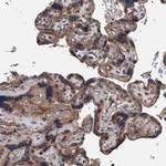 ITIH3 Antibody in Immunohistochemistry (Paraffin) (IHC (P))