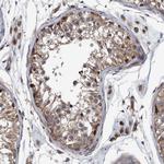 ITIH3 Polyclonal Antibody