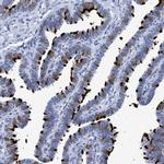 TSGA2 Antibody in Immunohistochemistry (IHC)