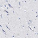 TSGA2 Antibody in Immunohistochemistry (IHC)