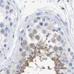 TSGA2 Antibody in Immunohistochemistry (IHC)