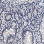 GPRASP2 Antibody in Immunohistochemistry (Paraffin) (IHC (P))