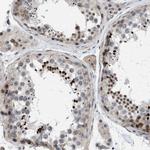 GPRASP2 Antibody in Immunohistochemistry (Paraffin) (IHC (P))
