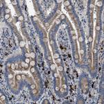 SGCZ Polyclonal Antibody