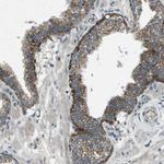FAM73A Antibody in Immunohistochemistry (Paraffin) (IHC (P))