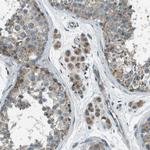 FAM73A Antibody in Immunohistochemistry (Paraffin) (IHC (P))