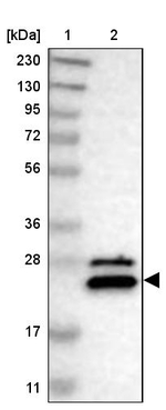 NUDT4 Antibody in Western Blot (WB)