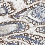 MGAT3 Polyclonal Antibody