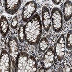 CLEC2D Antibody in Immunohistochemistry (Paraffin) (IHC (P))