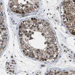 CLEC2D Polyclonal Antibody