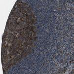 CLEC2D Antibody in Immunohistochemistry (Paraffin) (IHC (P))