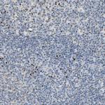 ENTPD4 Antibody in Immunohistochemistry (Paraffin) (IHC (P))