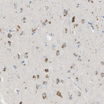 ENTPD4 Antibody in Immunohistochemistry (Paraffin) (IHC (P))