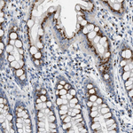 ENTPD4 Antibody in Immunohistochemistry (Paraffin) (IHC (P))