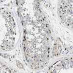 ENTPD4 Antibody in Immunohistochemistry (Paraffin) (IHC (P))