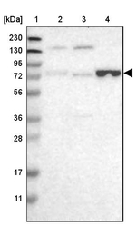 ENTPD4 Antibody in Western Blot (WB)