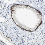 CYP4X1 Polyclonal Antibody