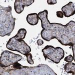 TMEM131 Polyclonal Antibody