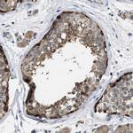 TMEM131 Polyclonal Antibody