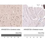 SGEF Antibody in Immunohistochemistry (Paraffin) (IHC (P))