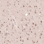 SGEF Polyclonal Antibody