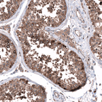 SGEF Antibody in Immunohistochemistry (Paraffin) (IHC (P))