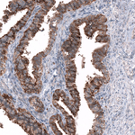 SGEF Antibody in Immunohistochemistry (Paraffin) (IHC (P))
