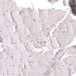 SGEF Antibody in Immunohistochemistry (Paraffin) (IHC (P))