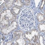 TEX264 Antibody in Immunohistochemistry (Paraffin) (IHC (P))