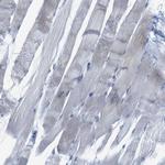 TEX264 Antibody in Immunohistochemistry (Paraffin) (IHC (P))