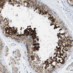 TEX264 Antibody in Immunohistochemistry (Paraffin) (IHC (P))