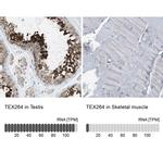 TEX264 Antibody in Immunohistochemistry (IHC)