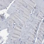 TEX264 Antibody in Immunohistochemistry (IHC)