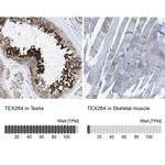 TEX264 Antibody
