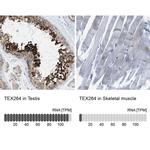TEX264 Antibody