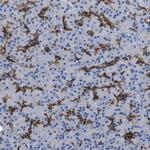ADCY10 Polyclonal Antibody
