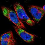 DLC1 Polyclonal Antibody