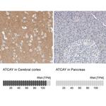 ATCAY Antibody in Immunohistochemistry (IHC)