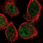 SLFN5 Polyclonal Antibody