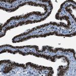 SLFN5 Antibody in Immunohistochemistry (Paraffin) (IHC (P))