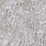 SLFN5 Antibody in Immunohistochemistry (Paraffin) (IHC (P))