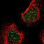 KLHL8 Antibody in Immunocytochemistry (ICC/IF)