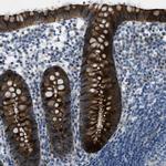 KLHL8 Antibody in Immunohistochemistry (IHC)