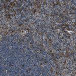 GIMAP8 Polyclonal Antibody