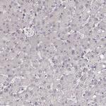 LY6K Antibody in Immunohistochemistry (Paraffin) (IHC (P))