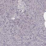 LY6K Antibody in Immunohistochemistry (Paraffin) (IHC (P))