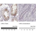 LY6K Antibody in Immunohistochemistry (IHC)